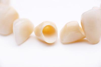 Picture of dental crowns at Beachwood Smiles