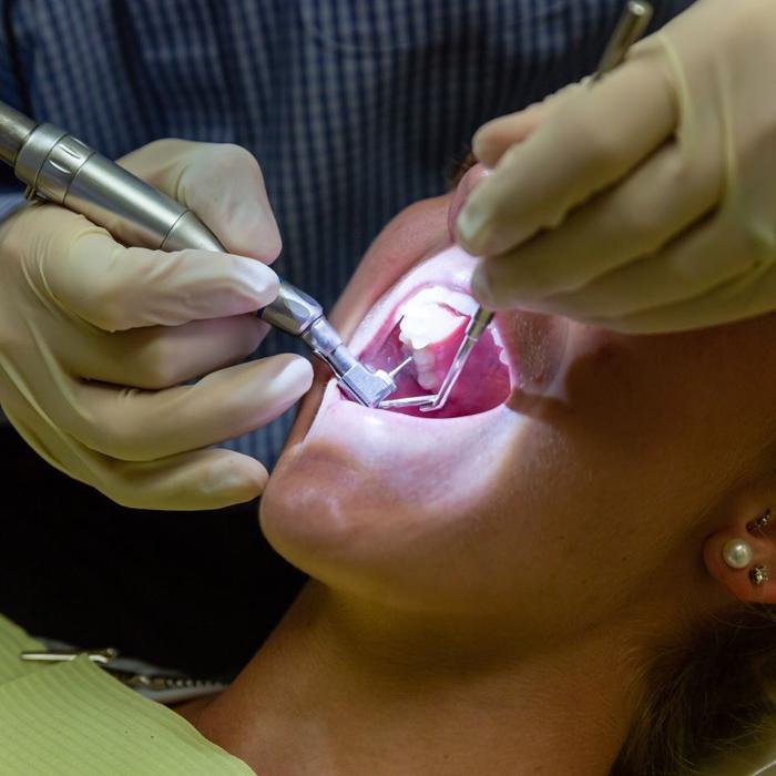 Close up of patient during dental exam with Beachwood OH dentist