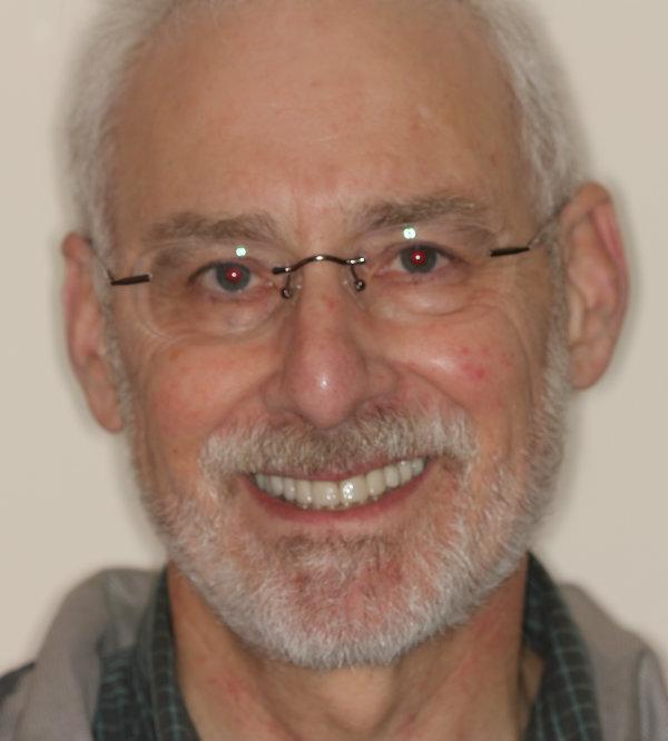 Dental Patient of Beachwood Smiles | 44122 Dentist Office