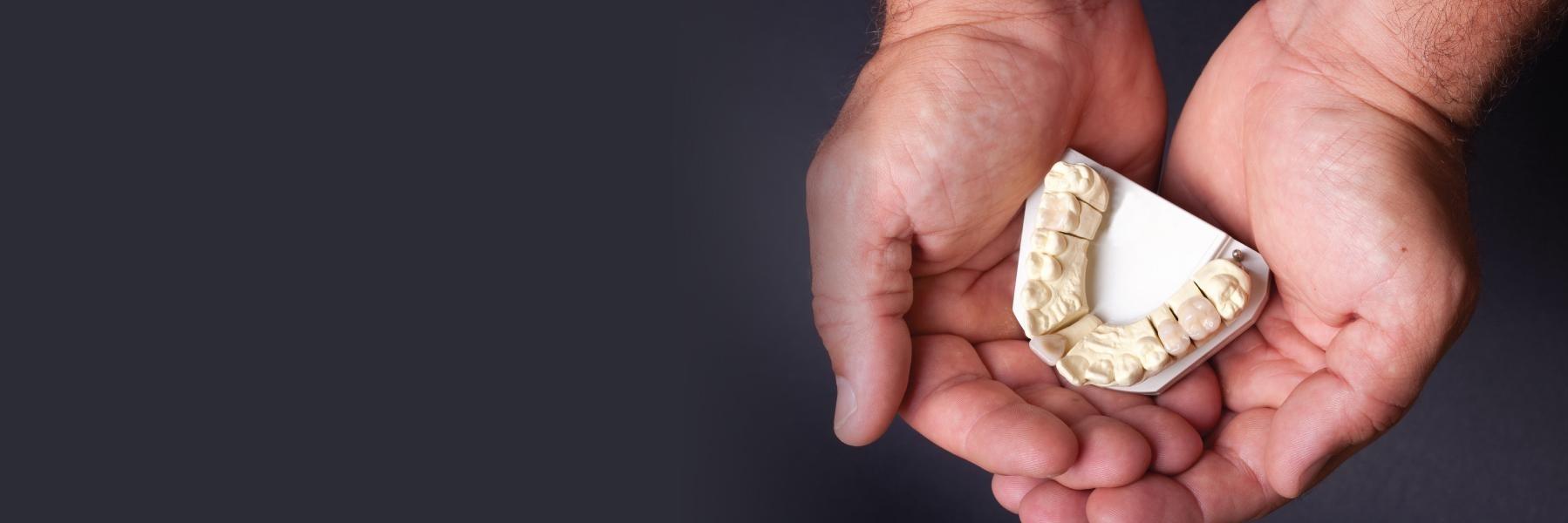 Hands holding a model of teeth for preventive dentistry near Shaker Heights, OH